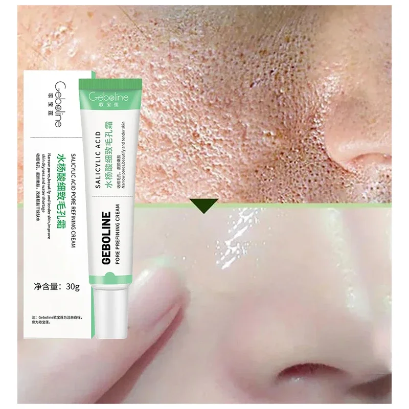 살리실산 모공 수축 크림, 빠른 제거, 큰 모공 제거, - Collagen Peptide Powder 리뷰 및 가격